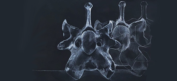 Madeline O. Smith, X Ray